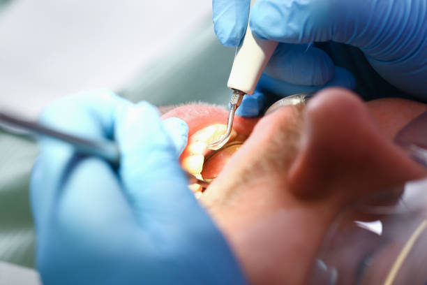 Best Emergency Treatment for Toothache in Old Orchard, PA